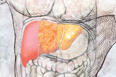 liver