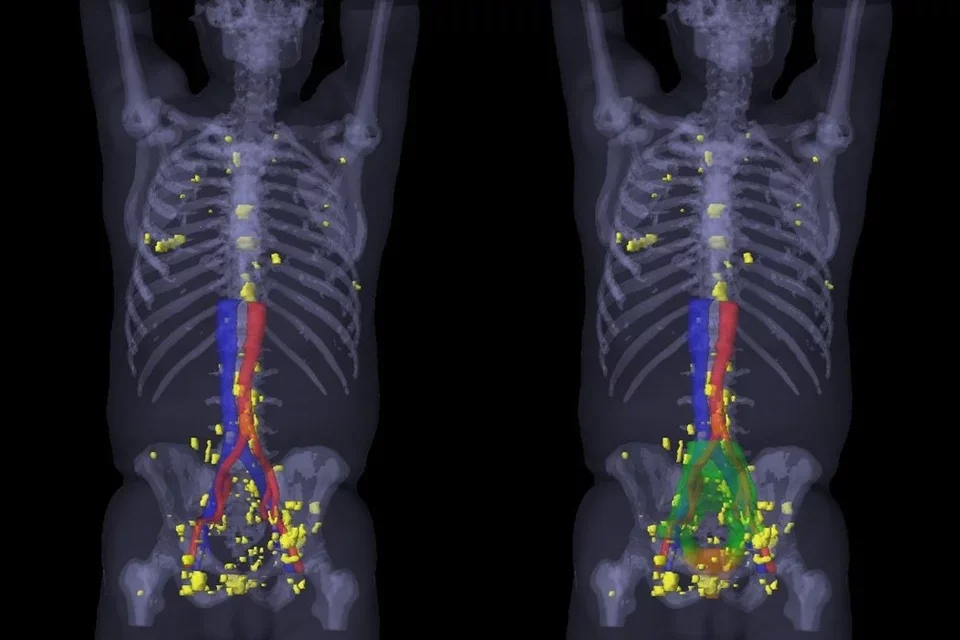 NUCLEAR MEDICINE, RADIOCHEMISTRY, & THERANOSTICS
