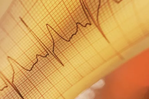 heart failure artwork